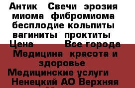 Антик.  Свечи (эрозия, миома, фибромиома, бесплодие,кольпиты, вагиниты, проктиты › Цена ­ 550 - Все города Медицина, красота и здоровье » Медицинские услуги   . Ненецкий АО,Верхняя Мгла д.